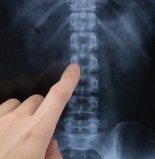 Ból kręgosłupa dbaj o zdrowie swoich dzieci Ból kręgosłupa dbaj o zdrowie swoich dzieci